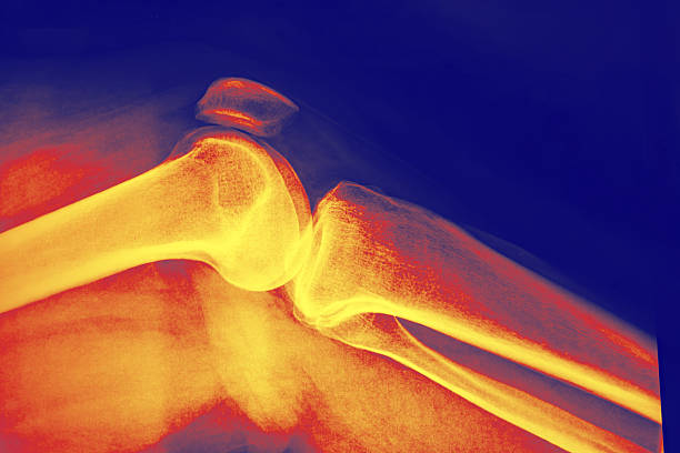 Joint and Bone Health